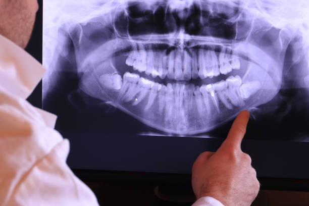 Best Emergency Dental Extractions in Wetumka, OK
