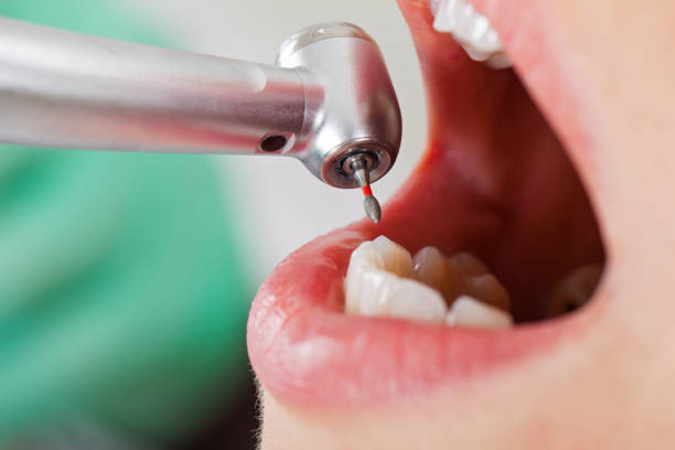 Best Pediatric Emergency Dentist in Wetumka, OK